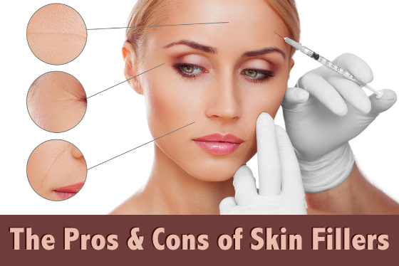 The Pros and Cons of Skin Fillers - Wrinkle Fillers - Facial Fillers