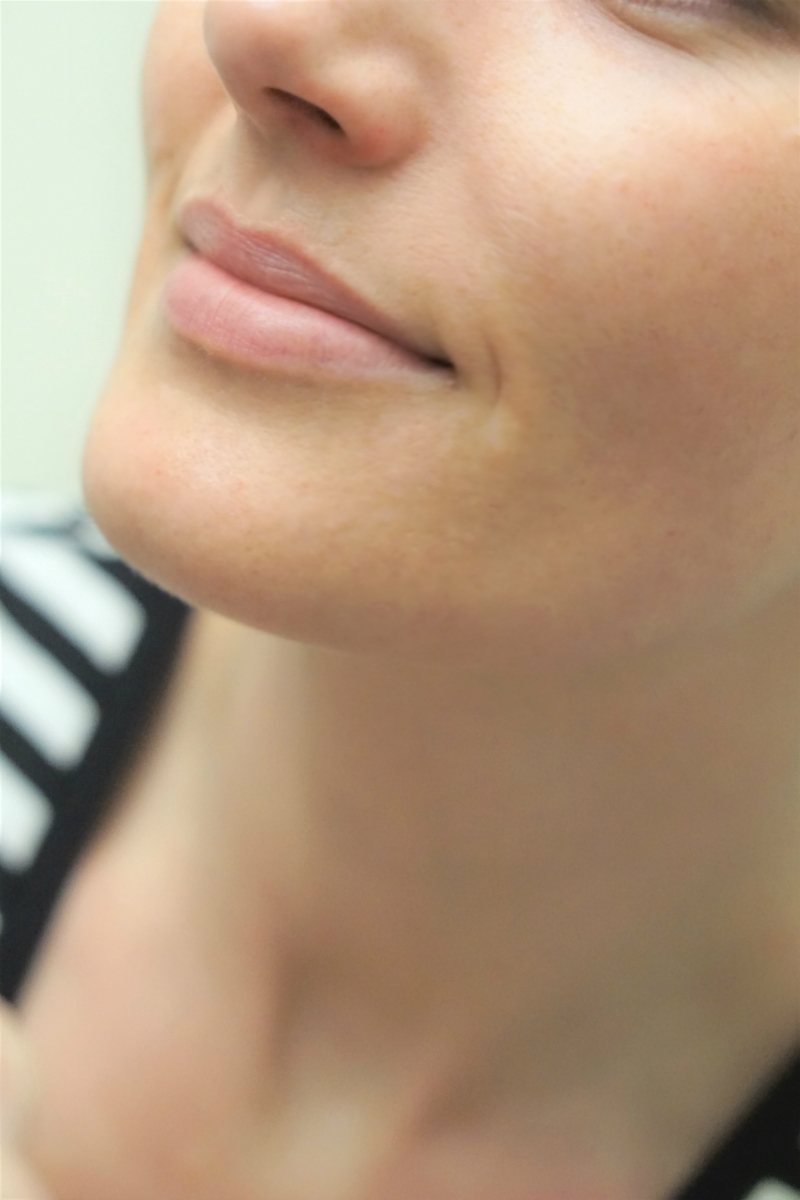 How To Heal Breakouts with The Neutrogena Light Therapy Acne Mask