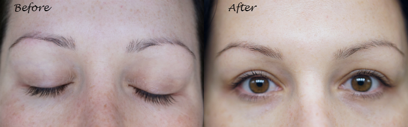 Olay 28 Day Challenge - Olay Regenerist Before and After Photos