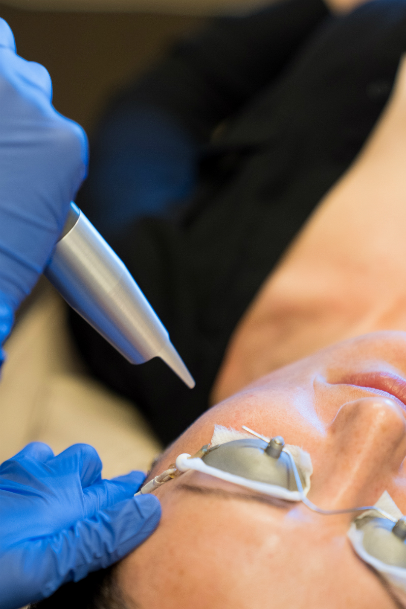 Face First Laser Skincare Series - Part 1 - The Benefits of Laser Skincare